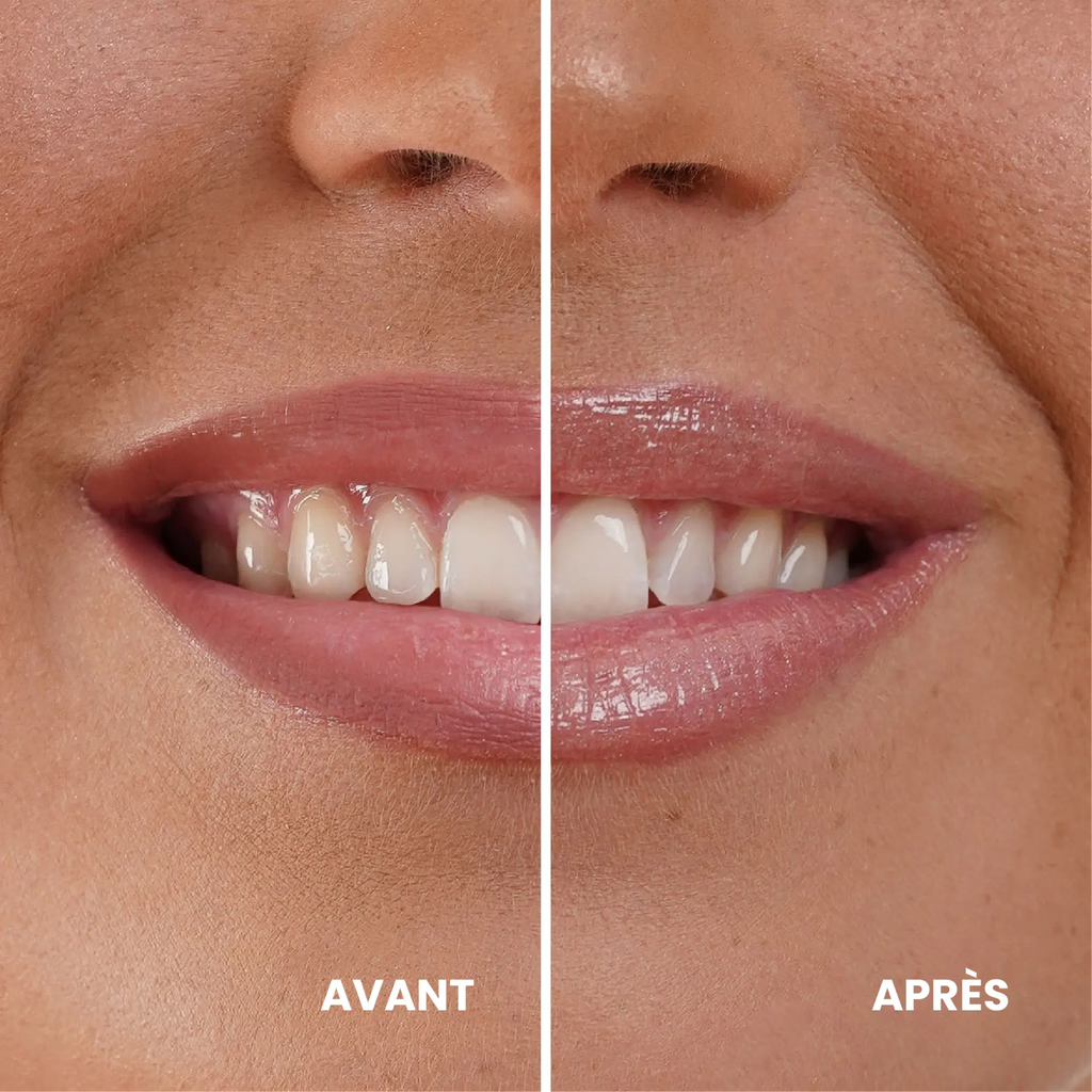 3701399706586 - le lip glow - Charlotte Bio